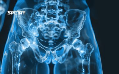 Recursos blog 1200 x 700 fractura pelvis